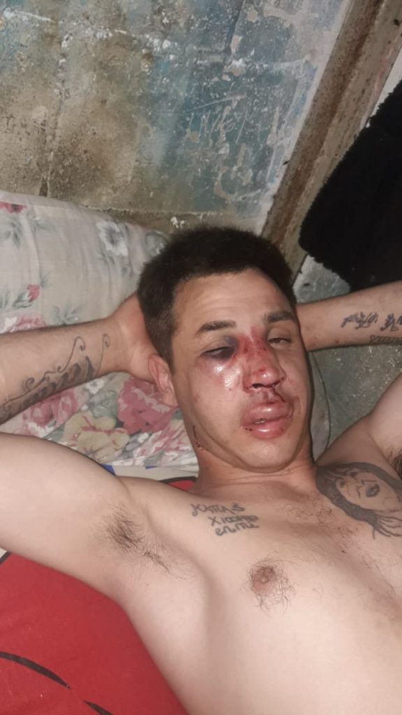 Sergio Chávez había sido golpeado la semana pasada.