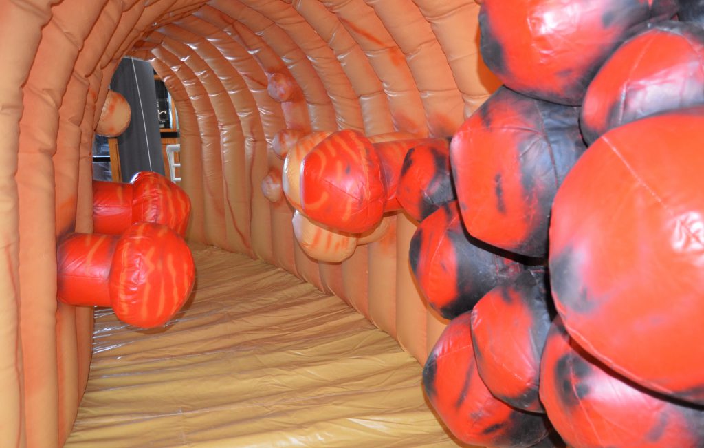 El colon inflable y gigante permite comprender como los pólipos que se forman pueden transformarse en tumores con el paso del tiempo.