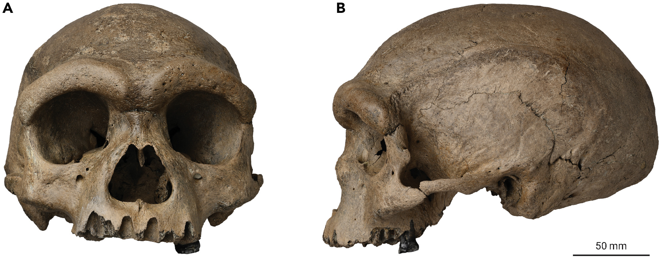 Harbin skull